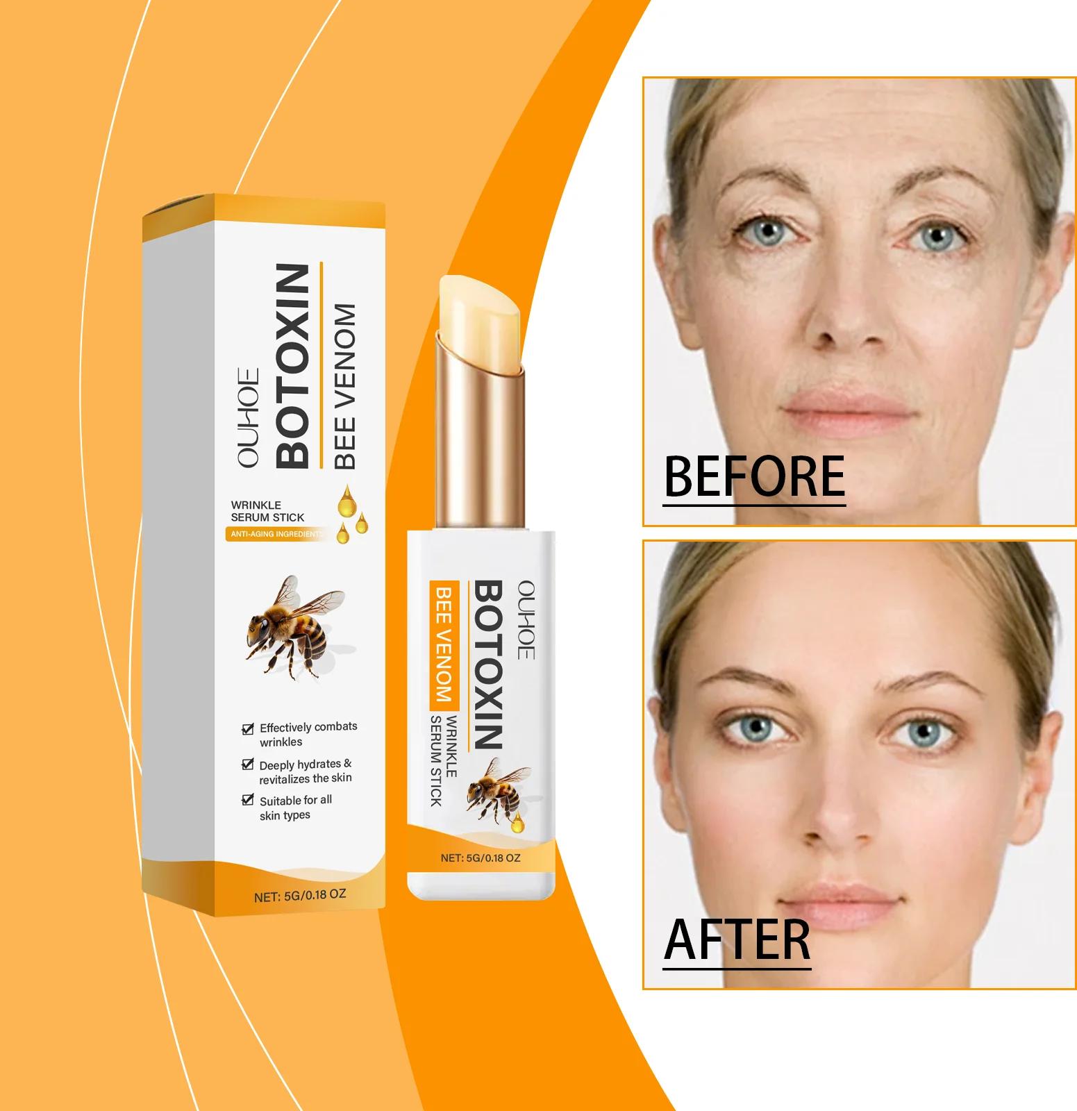 Botox Bee Venom Cream – Natural Face Lift & Wrinkle Remover Beauty Products Botox Bee Venom Cream – Natural Face Lift & Wrinkle Remover Beauty Products KDBazar online store: Extensive range of plus size leggings, workout leggings, and tights to suit your needs and style. Shop now and discover the ideal fit for you.