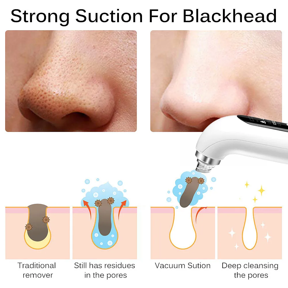 Electric Blackhead Vacuum Remover — Pore Suction Face Beauty Device Beauty & Personal Care Healthcare Hot Products Electric Blackhead Vacuum Remover — Pore Suction Face Beauty Device Beauty & Personal Care Healthcare Hot Products KDBazar